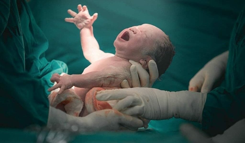 مخاض فی المنام