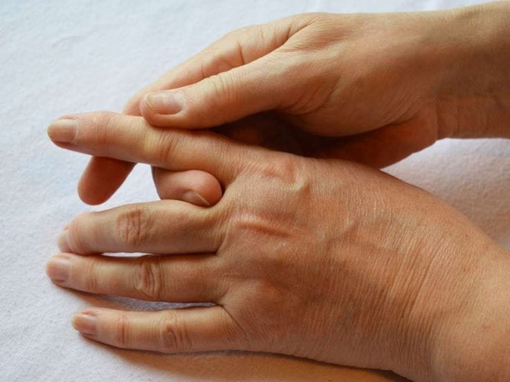 مقفع اليدين أو يابسهما فی المنام